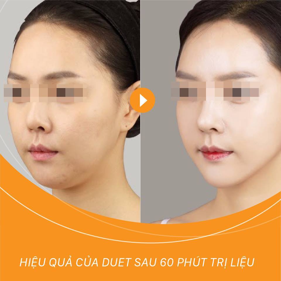 Hình ảnh trước sau trẻ hóa da